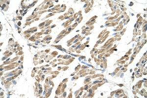Image no. 1 for anti-Solute Carrier Family 6 (Neurotransmitter Transporter, Creatine), Member 8 (SLC6A8) (AA 200-249) antibody (ABIN204991)