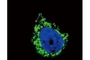 Confocal immunofluorescent analysis of IGFBP2 antibody with A549 cells followed by Alexa Fluor 488-conjugated goat anti-rabbit lgG (green).