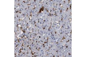 Immunohistochemical staining (Formalin-fixed paraffin-embedded sections) of human liver shows strong cytoplasmic positivity in Kupffer cells with CD300A polyclonal antibody  at 1:20 - 1:50 dilution. (CD300a 抗体  (AA 98-149))