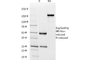 SDS-PAGE Analysis Purified IgD Mouse Monoclonal Antibody (IGD26). (IgD 抗体)