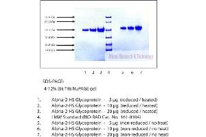 Gel Scan of Alpha 2 HS Glycoprotein, Human Plasma  This information is representative of the product ART prepares, but is not lot specific. (Fetuin A 蛋白)
