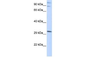 WB Suggested Anti-ZNF148 Antibody Titration:  0. (ZNF148 抗体  (Middle Region))