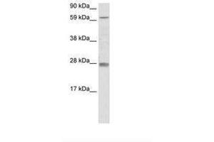 Image no. 1 for anti-Reproductive Homeobox 11 (RHOX11) (AA 61-110) antibody (ABIN6736075) (RHOX11 抗体  (AA 61-110))