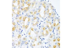 Immunohistochemistry of paraffin-embedded human stomach using CGB antibody. (Chorionic Gonadotropin, beta Polypeptide 3 (CGB3) 抗体)