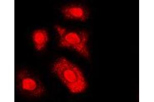 Immunofluorescent analysis of AKT (pT308) staining in HL60 cells. (AKT1 抗体  (pSer308))