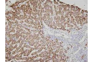 Immunohistochemistry of human liver tissue was incubated with AK3 monoclonal antibody , clone SJB3 - 36 (1 : 100)  for 2 hours at room temperature. (Adenylate Kinase 3 抗体)