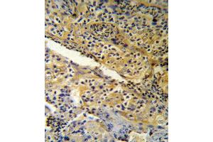 SPINK5 Antibody (N-term) (R) IHC analysis in formalin fixed and paraffin embedded human tonsil tissue followed by peroxidase conjugation of the secondary antibody and DAB staining. (SPINK5 抗体  (N-Term))