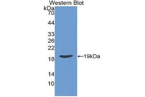 Western Blotting (WB) image for anti-Retinoic Acid Receptor Responder (Tazarotene Induced) 2 (RARRES2) (AA 21-155) antibody (ABIN1862319) (Chemerin 抗体  (AA 21-155))