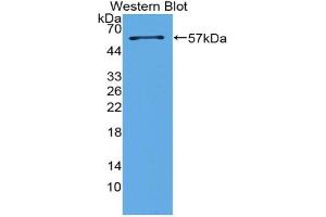 Western blot analysis of the recombinant protein. (Surfactant Protein A1 抗体  (AA 21-248))