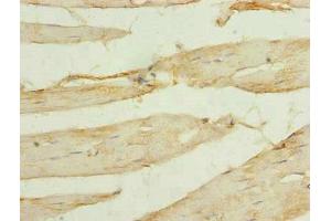 Immunohistochemistry of paraffin-embedded human skeletal muscle tissue using ABIN7175519 at dilution of 1:100