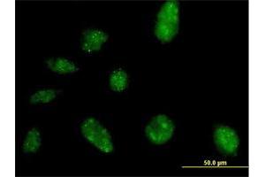 Immunofluorescence of purified MaxPab antibody to NARG2 on HeLa cell. (NARG2 抗体  (AA 1-332))