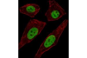 Immunofluorescence (IF) image for anti-Transcription Factor AP-2 delta (Activating Enhancer Binding Protein 2 Delta) (TFAP2D) antibody (ABIN2999809)