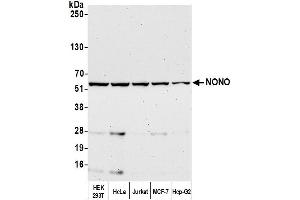 Western Blotting (WB) image for anti-Non-POU Domain Containing, Octamer-Binding (NONO) (AA 1-50) antibody (ABIN7453849)