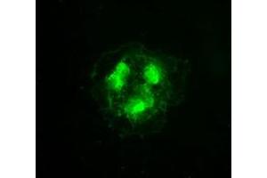 Anti-CDK5 mouse monoclonal antibody (ABIN2452276) immunofluorescent staining of COS7 cells transiently transfected by pCMV6-ENTRY CDK5 (RC200342).