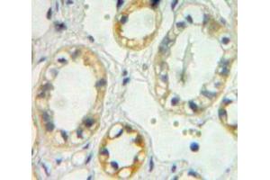 Used in DAB staining on fromalin fixed paraffin-embedded kidney tissue (TREH 抗体  (AA 237-420))