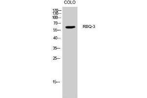 Western Blotting (WB) image for anti-Retinoblastoma Binding Protein 5 (RBBP5) (Internal Region) antibody (ABIN3177167) (RBBP5 抗体  (Internal Region))