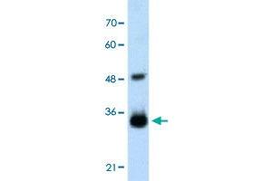 Western Blot analysis of transfected 293T cell lysate with HOXC9 polyclonal antibody  at 2. (HOXC9 抗体  (Internal Region))