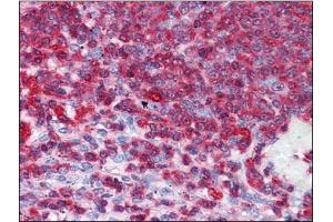 Human Spleen: Formalin-Fixed, Paraffin-Embedded (FFPE) (GDI2 抗体)