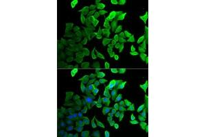 Immunofluorescence analysis of U2OS cells using Septin 2 antibody (ABIN6128758, ABIN6147552, ABIN6147553 and ABIN6221486). (Septin 2 抗体  (AA 112-361))