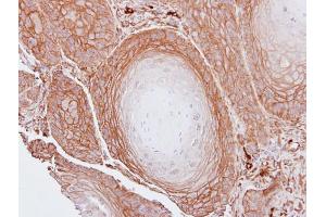 IHC-P Image Immunohistochemical analysis of paraffin-embedded Cal27 xenograft, using BAG3, antibody at 1:100 dilution. (BAG3 抗体  (C-Term))