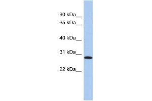 WB Suggested Anti-LYSMD1 Antibody Titration: 0. (LYSMD1 抗体  (N-Term))