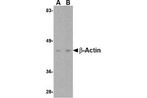 Western Blotting (WB) image for anti-Actin, beta (ACTB) (C-Term) antibody (ABIN1030291) (beta Actin 抗体  (C-Term))