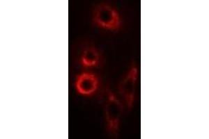 Immunofluorescent analysis of SMAC staining in SW620 cells. (DIABLO 抗体)