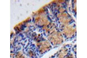 Used in DAB staining on fromalin fixed paraffin-embedded Bowels tissue (MANF 抗体  (AA 28-182))