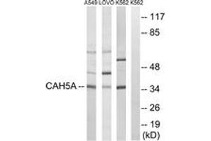 Western blot analysis of extracts from A549/LOVO/K562 cells, using CA5A Antibody.