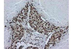 Image no. 2 for anti-Heterogeneous Nuclear Ribonucleoprotein A2/B1 (HNRNPA2B1) antibody (ABIN108621) (HNRNPA2B1 抗体)