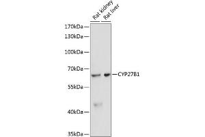 Western blot analysis of extracts of various cell lines, using CYP27B1 antibody (ABIN6130955, ABIN6139327, ABIN6139328 and ABIN6218814) at 1:3000 dilution. (CYP27B1 抗体  (AA 25-195))