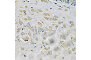 Immunohistochemistry of paraffin-embedded rat brain using SAR1A Antibody (ABIN4905086) at dilution of 1:100 (40x lens). (SAR1A 抗体)