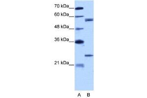 WB Suggested Anti-CPNE1  Antibody Titration: 5. (CPNE1 抗体  (N-Term))