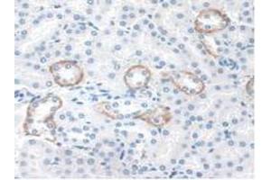 IHC-P analysis of Mouse Kidney Tissue, with DAB staining. (STAM2 抗体  (AA 1-377))