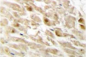 Immunohistochemistry (IHC) analyzes of PEBP2beta antibody in paraffin-embedded human heart tissue. (CBFB 抗体)