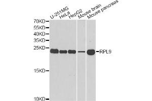 Western blot analysis of extracts of various cell lines, using RPL9 antibody (ABIN5973807) at 1/1000 dilution. (RPL9 抗体)