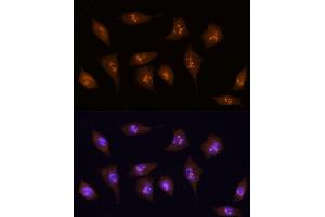 Immunofluorescence analysis of L929 using KDM5B antibody (ABIN6132287, ABIN6142802, ABIN6142803 and ABIN6223724) at dilution of 1:100 (40x lens). (KDM5B 抗体  (AA 784-883))