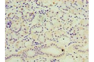 Immunohistochemistry of paraffin-embedded human pancreatic tissue using ABIN7169409 at dilution of 1:100 (SESN3 抗体  (AA 1-310))