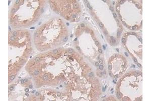 Immunohistochemistry (IHC) image for anti-N-Acylsphingosine Amidohydrolase (Acid Ceramidase) 1 (ASAH1) (AA 144-395) antibody (ABIN7434806)
