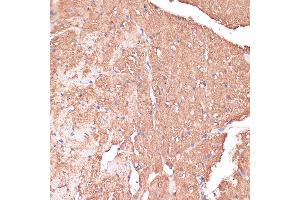 Immunohistochemistry of paraffin-embedded Mouse heart using FRMD6 antibody (ABIN6132194, ABIN6140773, ABIN6140774 and ABIN6225347) at dilution of 1:100 (40x lens). (FRMD6 抗体  (AA 405-614))