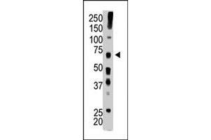The USP22 polyclonal antibody  is used in Western blot to detect USP22 in mouse brain tissue lysate . (USP22 抗体  (C-Term))