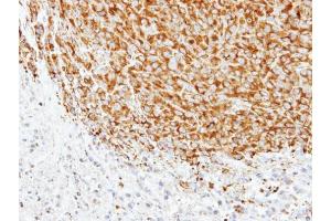 IHC-P Image Immunohistochemical analysis of paraffin-embedded SAS xenograft, using alpha Tubulin 1A, antibody at 1:500 dilution. (TUBA1A 抗体)