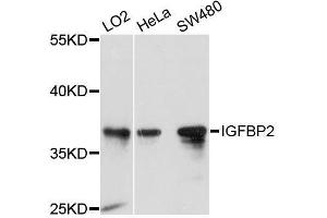 Western blot analysis of extracts of various cell lines, using IGFBP2 antibody. (IGFBP2 抗体  (AA 100-200))