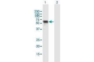 Western Blot analysis of NUP62 expression in transfected 293T cell line by NUP62 MaxPab polyclonal antibody. (NUP62 抗体  (AA 1-522))