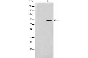 Western blot analysis on HuvEc cell lysate using Involucrin Antibody. (Involucrin 抗体)