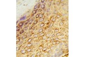 Immunohistochemistry analysis in formalin-fixed and paraffin-embedded human skin tissue reacted with LDHA Antibody (Center) Cat. (Lactate Dehydrogenase A 抗体  (Middle Region))