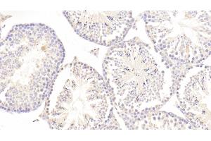 Detection of ERb in Mouse Testis Tissue using Polyclonal Antibody to Estrogen Receptor Beta (ERb) (ESR2 抗体  (AA 46-530))