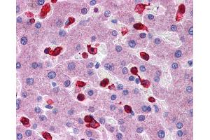 Immunohistochemistry (IHC) image for anti-Peroxiredoxin 2 (PRDX2) (Middle Region) antibody (ABIN2783315) (Peroxiredoxin 2 抗体  (Middle Region))
