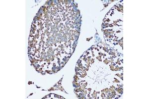 Immunohistochemistry of paraffin-embedded mouse testis using SQS/FDFT1 antibody (ABIN6130393, ABIN6140567, ABIN6140568 and ABIN6221824) at dilution of 1:100 (20x lens). (FDFT1 抗体  (AA 1-260))