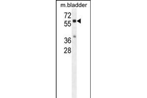 Western Blotting (WB) image for anti-Cathepsin A (CTSA) (AA 18-45), (N-Term) antibody (ABIN654433)